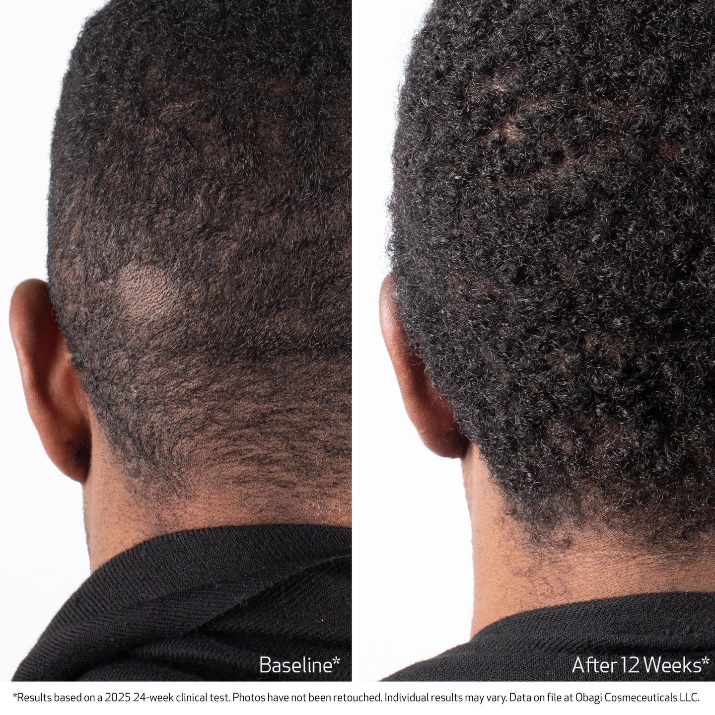 BIOSTIM™ SCALP SERUM